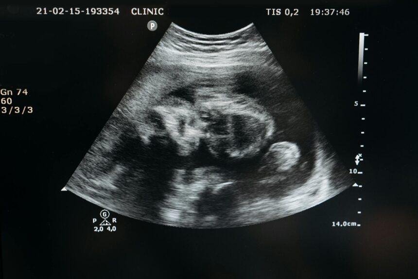 ultrasound of an unborn child