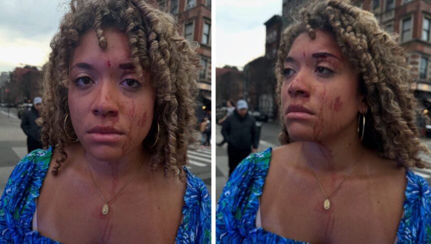 pro-life-nyc-attack